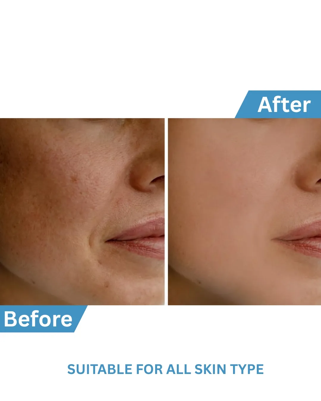 Detan Face Mask image 6